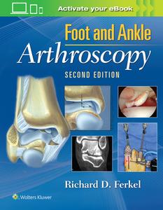 Foot & Ankle Arthroscopy (2nd Edition)