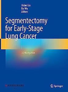 Segmentectomy for Early-Stage Lung Cancer 3D Navigation