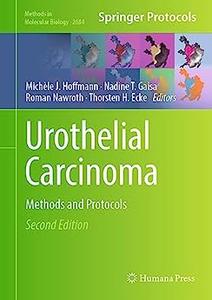 Urothelial Carcinoma (2nd Edition)