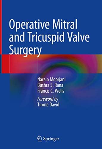 Operative Mitral and Tricuspid Valve Surgery 
