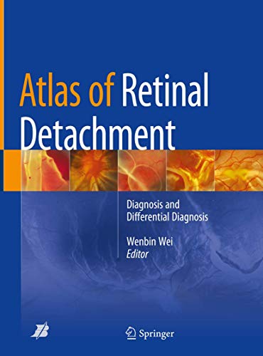 Atlas of Retinal Detachment Diagnosis and Differential Diagnosis 
