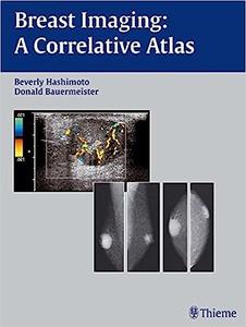 Breast Imaging A Correlative Atlas
