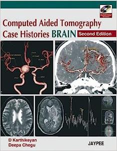 Computed Aided Tomography Case Histories BRAIN