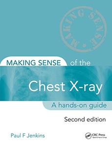 Making Sense of the Chest X-ray A hands-on guide