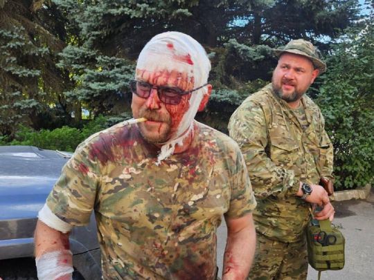 Колишнього лідера донбаських бойовиків бородая поранено внаслідок обстрілу ЗСУ(фото)