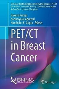 PET CT in Breast Cancer