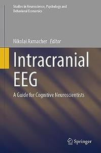 Intracranial EEG A Guide for Cognitive Neuroscientists