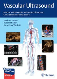 Vascular Ultrasound B–Mode, Color Doppler and Duplex Ultrasound, Contrast–Enhanced Ultrasound