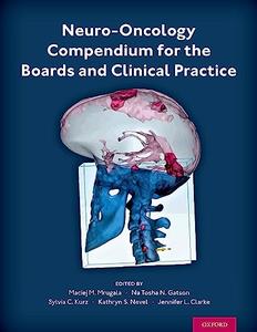 Neuro–Oncology Compendium for the Boards and Clinical Practice