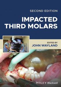 Impacted Third Molars, 2nd Edition