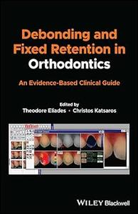 Debonding and Fixed Retention in Orthodontics An Evidence–Based Clinical Guide