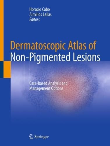 Dermatoscopic Atlas of Non–Pigmented Lesions Case–based Analysis and Management Options