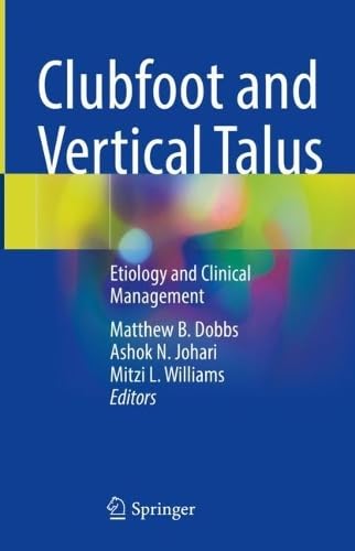 Clubfoot and Vertical Talus Etiology and Clinical Management