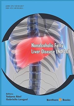 Nonalcoholic Fatty Liver Disease