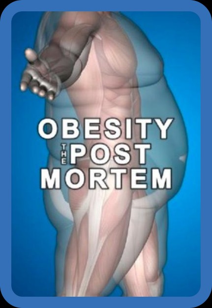 Obesity The Post Mortem (2016) 1080p WEBRip x264-RARBG