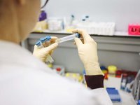 У Вінниці підтверджено 84 випадки вірусного гепатиту А