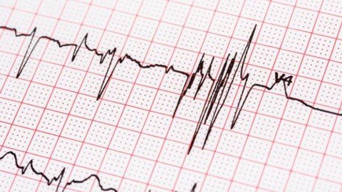 Ecg Guide – Mastering Ecg One Pulse At A Time