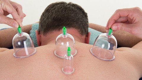 Myofascial And Trigger Points Release With Cupping Therapy