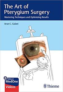 The Art of Pterygium Surgery Mastering Techniques and Optimizing Results