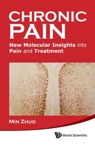 Chronic Pain New Molecular Insights into Pain and Treatment