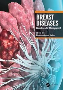 Breast Diseases Guidelines for Management