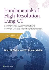 Fundamentals of High–Resolution Lung CT, 2nd Edition