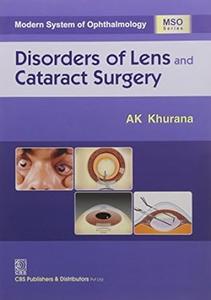Disorders of Lens and Cataract Surgery