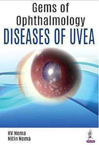 Gems of Ophthalmology–Diseases of Uvea
