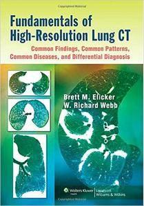Fundamentals of High–resolution Lung CT