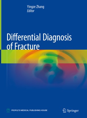 Differential Diagnosis of Fracture (2024)