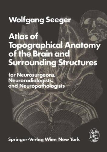 Atlas of Topographical Anatomy of the Brain and Surrounding Structures for Neurosurgeons