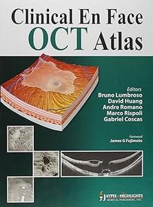 Clinical En Face OCT Atlas