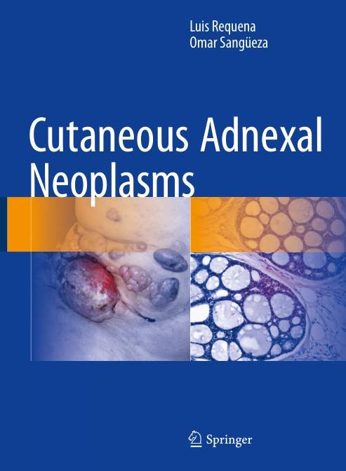Cutaneous Adnexal Neoplasms (2024)
