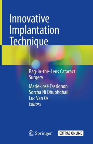 Innovative Implantation Technique Bag–in–the–Lens Cataract Surgery (2024)