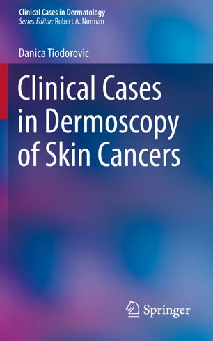 Clinical Cases in Dermoscopy of Skin Cancers (2024)