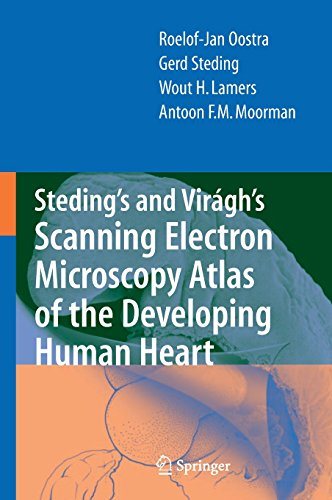 Steding's and Virágh's Scanning Electron Microscopy Atlas of the Developing Human Heart