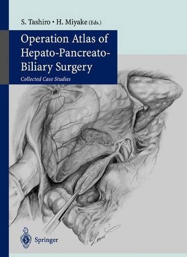 Operation Atlas of Hepato-Pancreato-Biliary Surgery Collected Case Studies