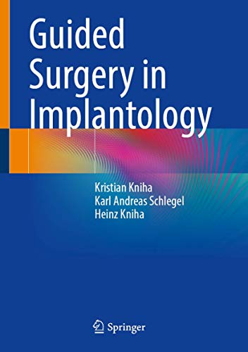 Guided Surgery in Implantology (2024)