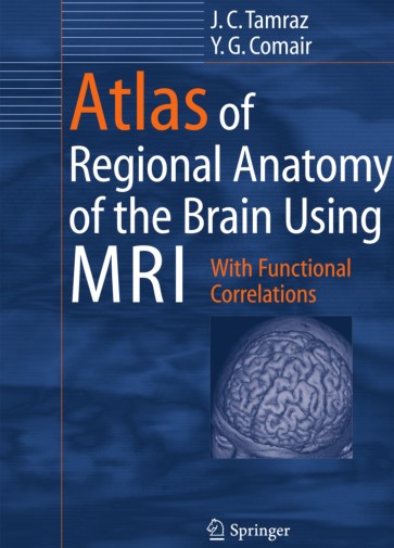 Atlas of Regional Anatomy of the Brain Using MRI With Functional Correlations