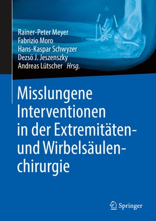 Misslungene Interventionen in der Extremitäten- und Wirbelsäulenchirurgie (2024)