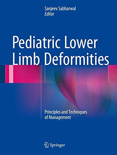 Pediatric Lower Limb Deformities Principles and Techniques of Management (2024)