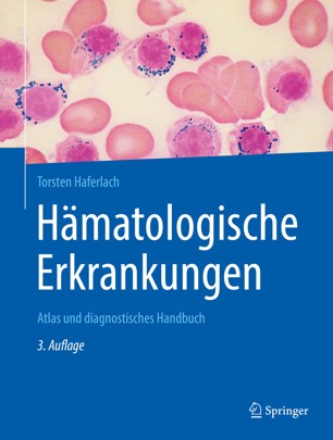 Hämatologische Erkrankungen Atlas und diagnostisches Handbuch (2024)