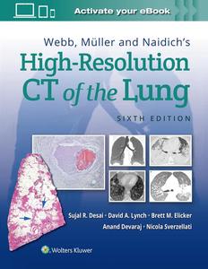 Webb, Müller and Naidich’s High-Resolution CT of the Lung (6th Edition) (2024)