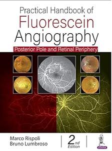 Practical Handbook of Fluorescein Angiography (2nd Edition)