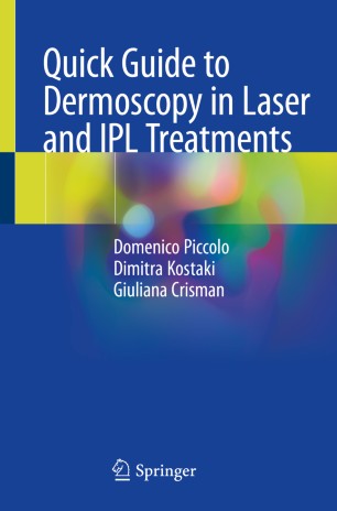 Quick Guide to Dermoscopy in Laser and IPL Treatments (2024)