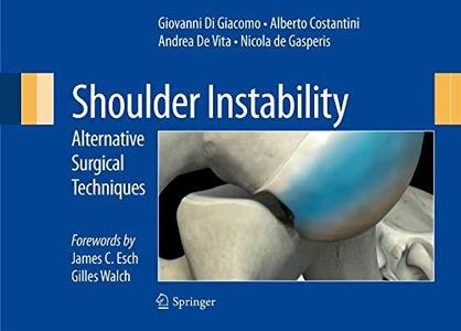 Shoulder Instability Alternative Surgical Techniques