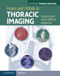 Pearls and Pitfalls in Thoracic Imaging Variants and Other Difficult Diagnoses