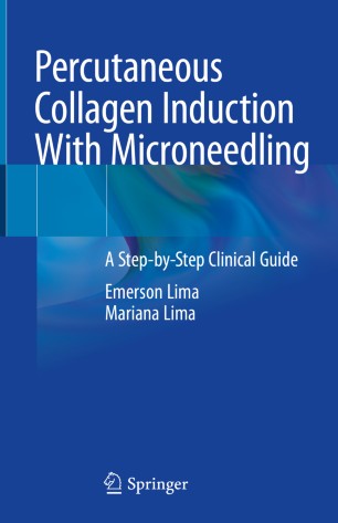 Percutaneous Collagen Induction With Microneedling A Step-by-Step Clinical Guide