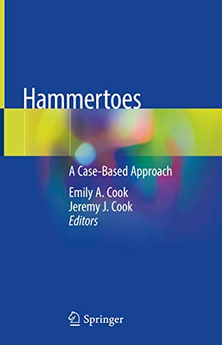 Hammertoes A Case-Based Approach (2024)