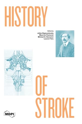 History of Stroke